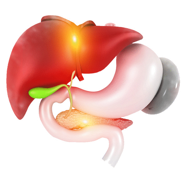 Laparoscopic Vertical Sleeve Gastrectomy