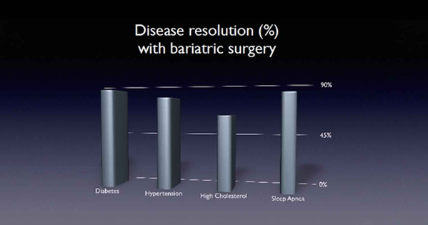 Life After Bariatric Surgery